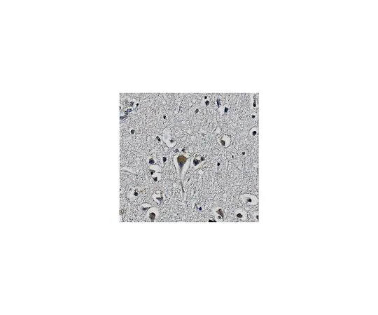 62-8517-59　抗KChIP2钾通道亚基抗体，克隆60/73猫。不，是MABN371　MABN371