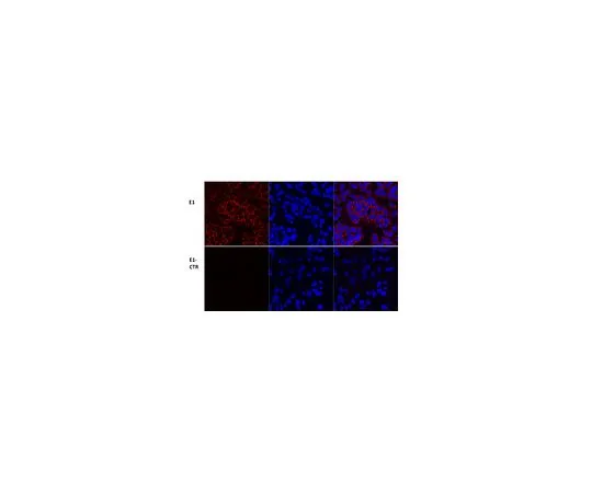 62-8472-11　抗PDH　ABS2082