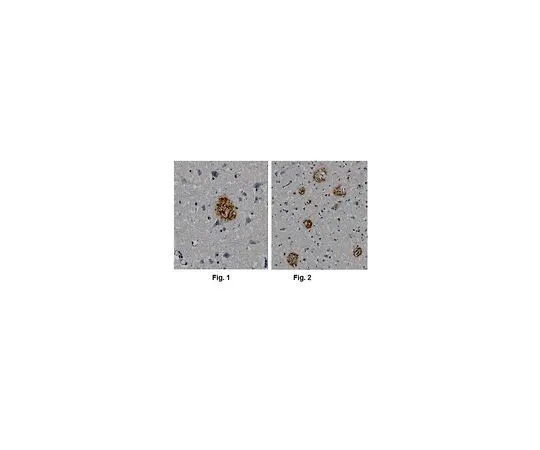 62-8518-73　抗淀粉样蛋白βA4,克隆1E8 (氨基酸末端)　MABN639