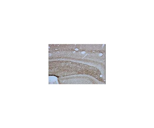 62-8497-34　抗神经丝200 kDa,克隆RT97;50μg　MAB5262