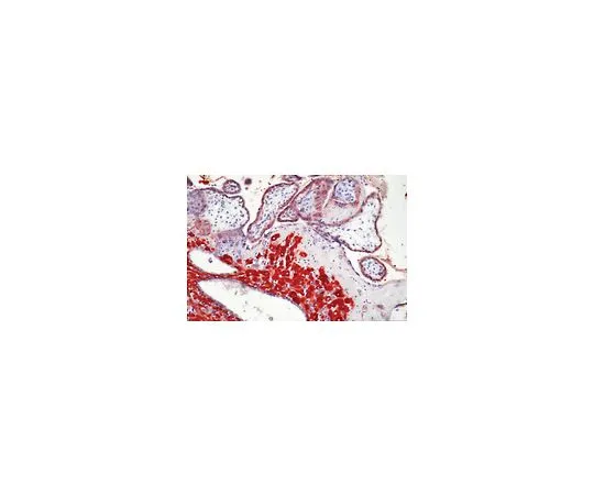 62-8500-34　抗MMP-2,亲和活性形式，克隆A-GelVC2;500μL　MAB13431