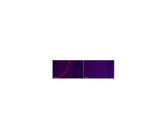 62-8494-89　抗Tau抗体，克隆PC1C6, Alexa Fluor (R) 555共轭　MAB3420-AF555