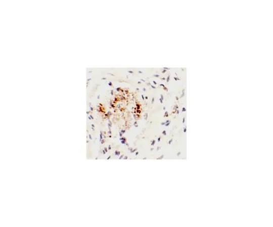 62-8470-22　反LEMD3　ABS460