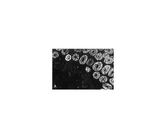 62-8494-55　抗细胞角蛋白18,克隆RCK106;100μg　MAB3236