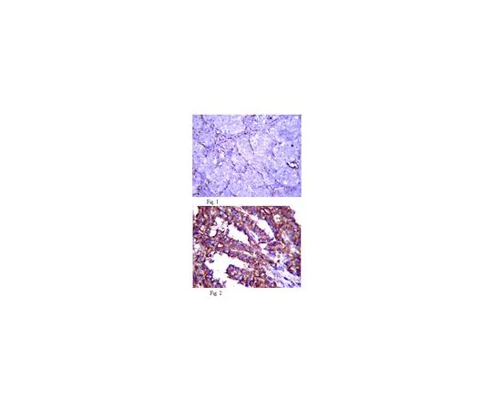 62-8494-07　抗纤维蛋白2,克隆48;100μg　MAB2642