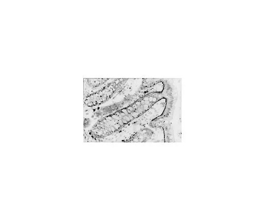 62-8490-93　抗整合素α6,克隆NKI-GoH3;100μg　MAB1378