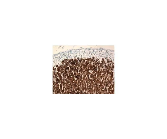 62-8498-57　抗细胞色素P45011β-羟基酶，克隆11B2-1A4;500μL　MAB6020
