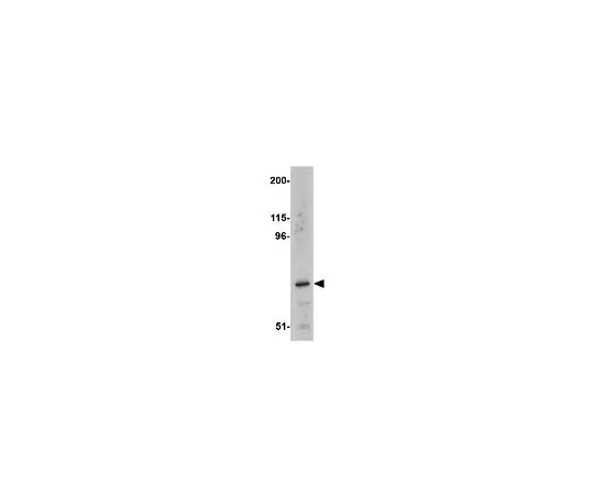 62-8470-19　抗ASAH2　ABS457