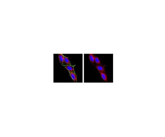62-8491-03　抗巨噬细胞/粒细胞，克隆OX-41;100μg　MAB1407P