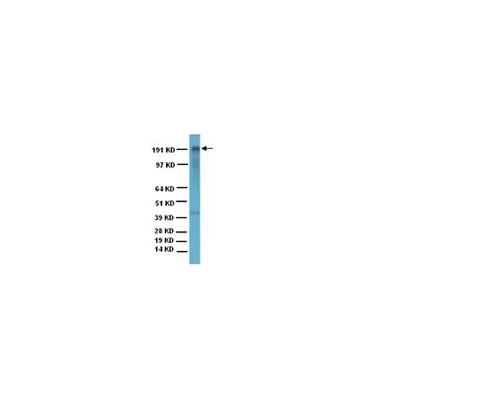 62-8494-83　抗MAP2,克隆AP20;200μg　MAB3418