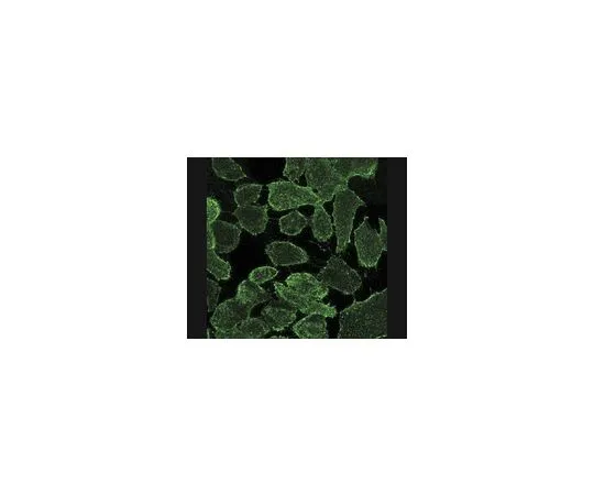 62-8496-19　抗MDR1,细胞外人特异性Pgp,克隆MM4.17;100μg　MAB4162
