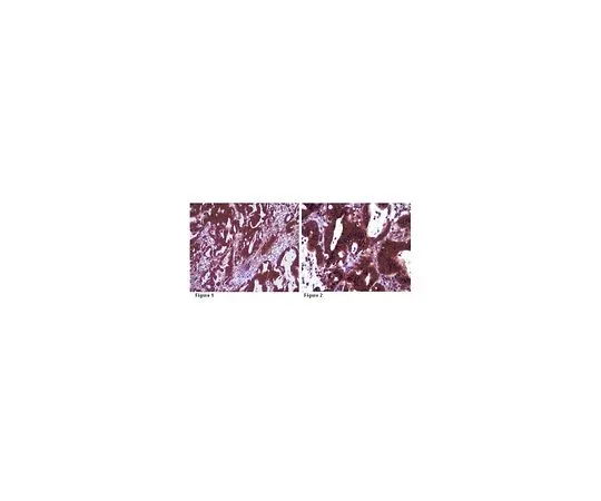 62-8472-48　抗INF2;100μg　ABT61
