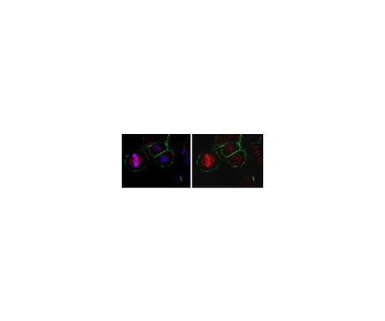 62-8472-21　抗CKAP5;100μL　ABT10