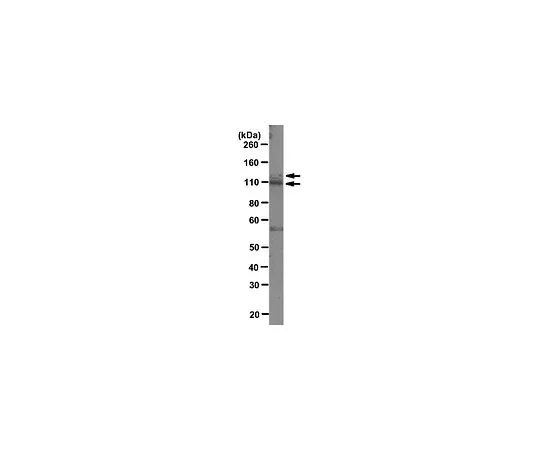 62-8521-88　抗PARG,克隆D8B10;100μg　MABS61