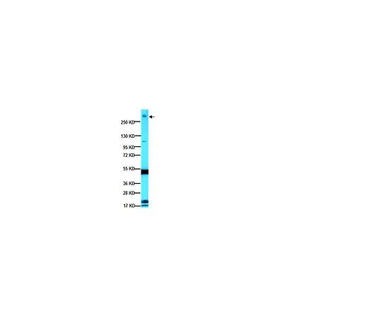 62-8489-22　抗MAP2A,2B;100μL　MAB378