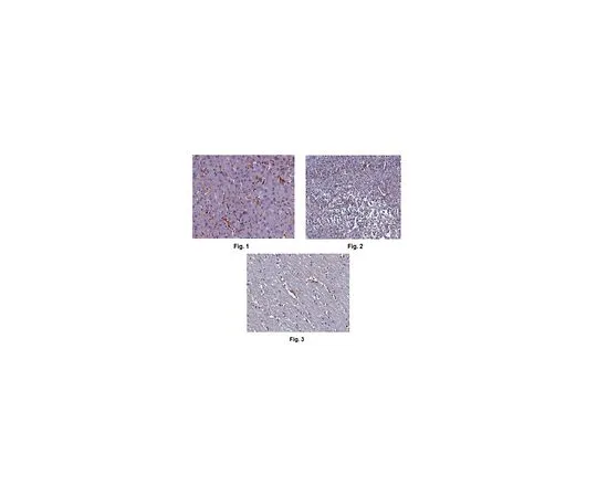 62-8519-77　抗忍者蛋白-1/NINJ1抗体，克隆12H6.1　MABN816