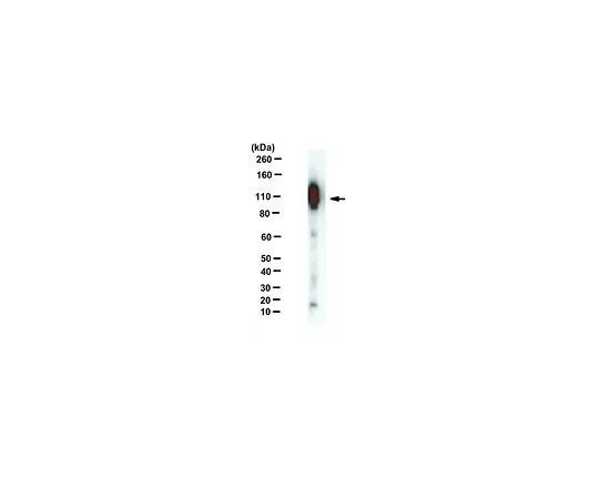 62-8517-66　抗APP-C99,克隆mC99 (1-7)　MABN381