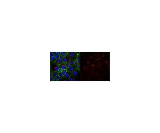 62-8491-57　抗细胞角蛋白5,6抗体，克隆D5/16B4,Alexa Fluor (R) 555　MAB1620-AF555