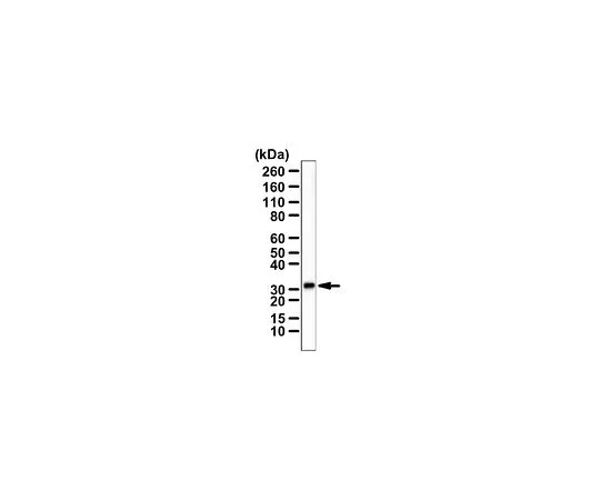 62-8470-73　抗CH25H　ABS562