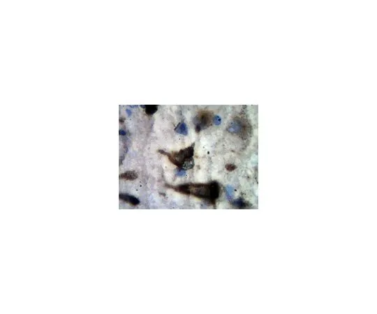 62-8500-25　抗5-羟色胺受体1A,克隆19A9.2;100μg　MAB11041