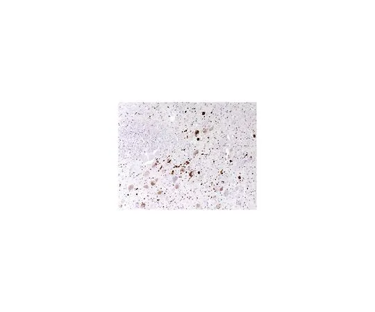 62-8517-70　抗聚集-突触核蛋白，克隆5G4　MABN389