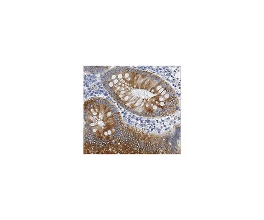 62-8494-77　抗细胞角蛋白18克隆CK2 (无腹水)　MAB3404-C