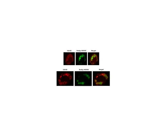 62-8471-79　抗CGI-58抗体　ABS1616