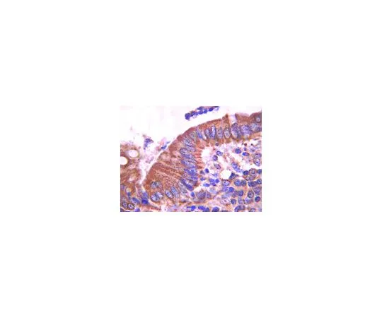 62-8525-19　抗E-钙粘蛋白，克隆DECMA-1;100μg　MABT26
