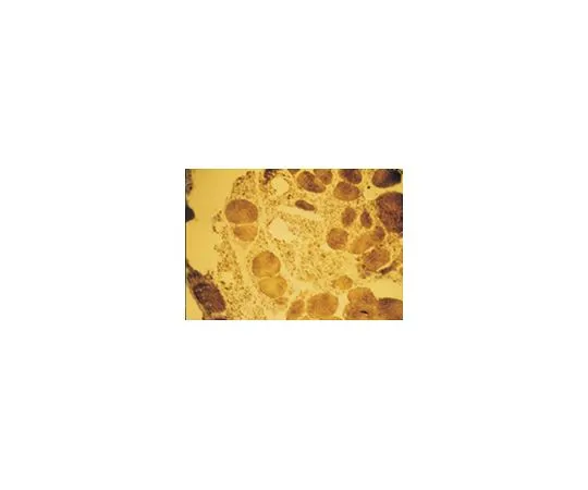 62-8491-62　抗肌球蛋白，慢肌，克隆NOQ7.5.4D;100μg　MAB1628