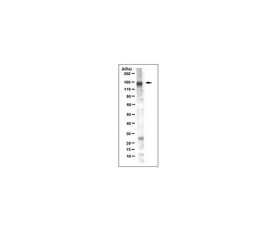 62-8524-09　抗LDL受体抗体，克隆2H7.1　MABS1208