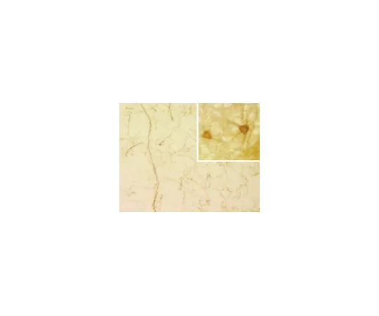 62-8491-25　抗5-羟色胺转运蛋白，克隆17-7A4;100μg　MAB1564