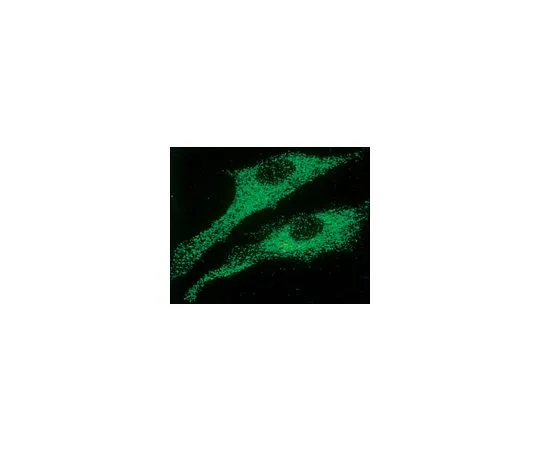 62-8494-27　抗Ryanodine受体，克隆RYR.1;50μg　MAB3086