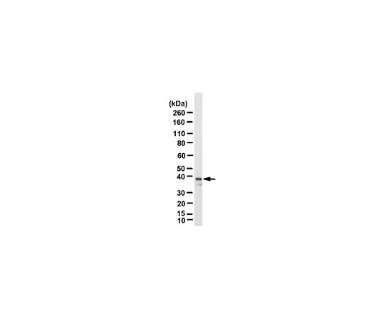 62-8469-71　抗YVHH1;100μL　ABS224