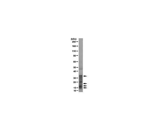 62-8504-97　抗组织蛋白，H1+核心蛋白，克隆F152.C25.WJJ;100μg　MABE71