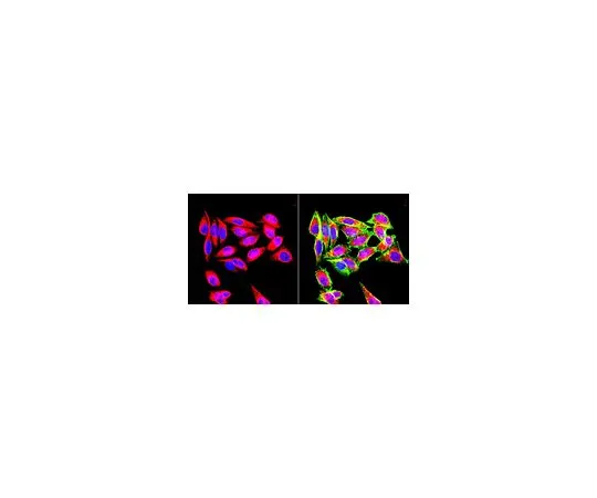 62-8479-44　抗波形蛋白，克隆VIM3B4;50μg　CBL202