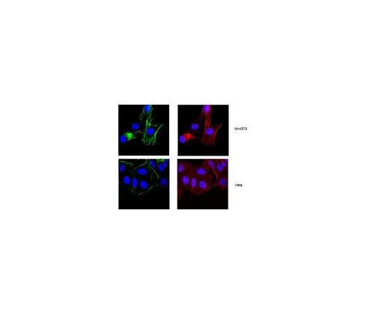 62-8491-12　反阿克丁，在a.a附近。50-70,克隆C4;100μg　MAB1501R