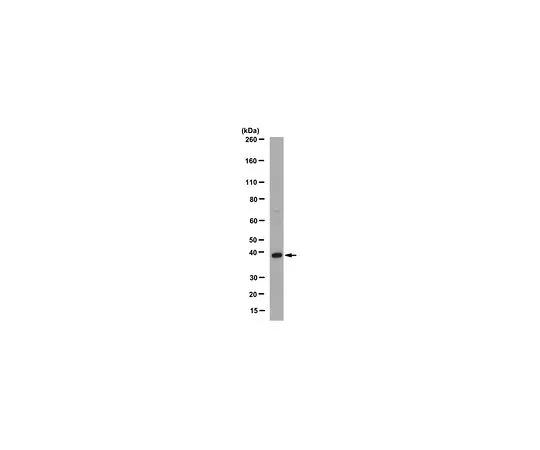 62-8525-56　Anti-Srclike-adapter/SLAP1, clone 1D9.1　MABT107