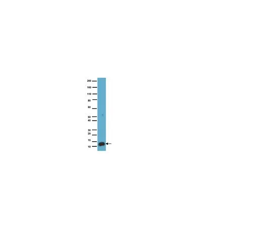 62-8488-37　抗S-100蛋白，克隆15E2E2;100μL　MAB079-1