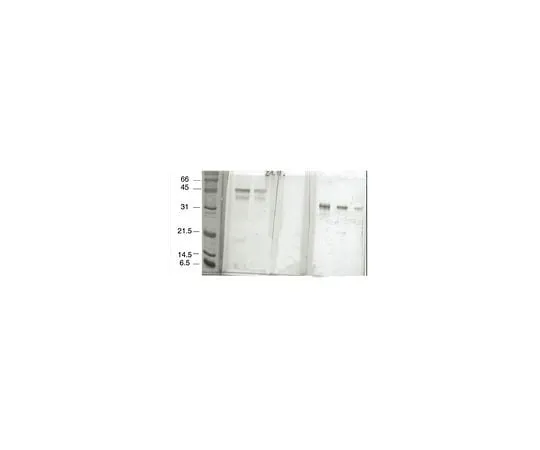 62-8497-61　抗RAGE,克隆DD/A11或mAbA11;100μg　MAB5328