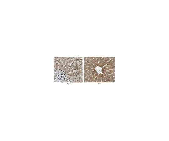 62-8473-62　抗Matriptase2/TMPRSS6　ABT317