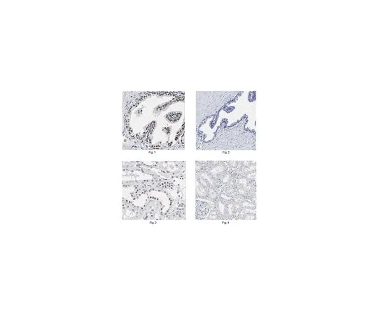 62-8522-99　抗P40,克隆11F12.1　MABS519