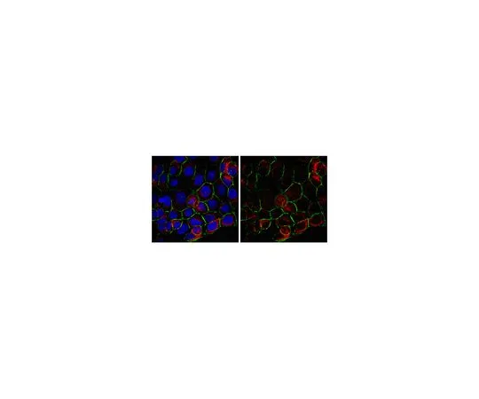 62-8472-30　抗肌动蛋白3;100μg　ABT29