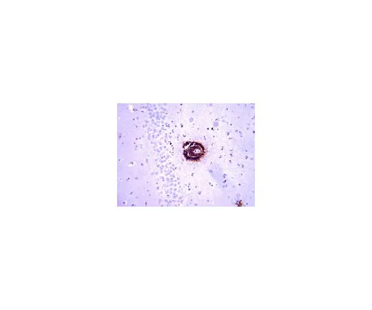 62-8516-32　抗淀粉样蛋白β40,克隆G2-10;50μg　MABN11