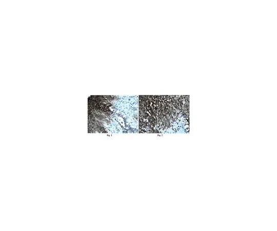 62-8525-24　抗层粘连蛋白亚基α-4,克隆3H2;100μL　MABT38