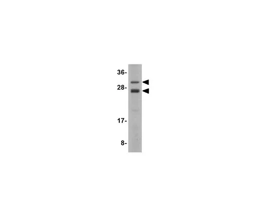 62-8470-11　抗CSN8　ABS448