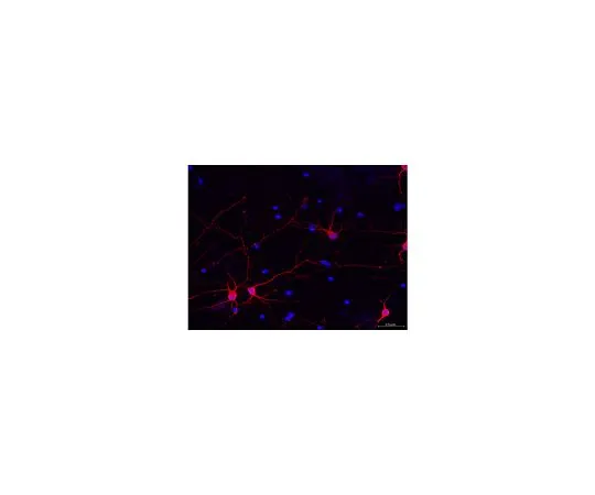 62-8493-70　MilliMark (TM) 泛神经元标记;100μL　MAB2300