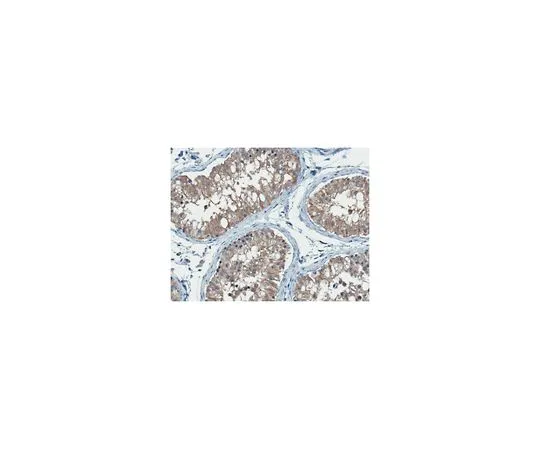 62-8519-87　抗视网膜脱氢酶1/ALDH1A1抗体，克隆8D7.1　MABN838