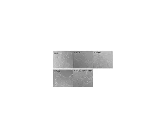 62-8482-12　纤维蛋白体外血管生成测定;1个套件　ECM630