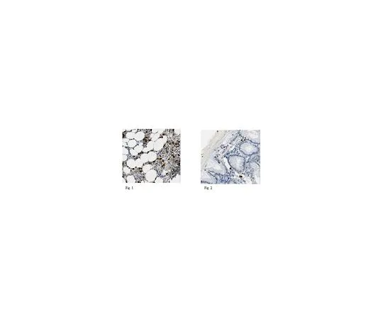62-8518-01　抗Lipocalin-2,克隆PA348-26.3.5　MABN481