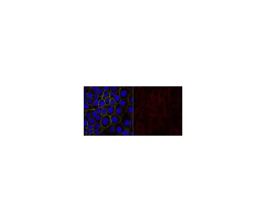 62-8491-56　抗细胞角蛋白5,6抗体，克隆D5/16B4,Alexa Fluor (R) 488　MAB1620-AF488